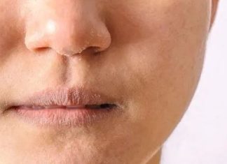 Pucanje koze,trnci ili opadanje kose su prvi znakovi