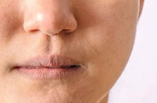 Pucanje koze,trnci ili opadanje kose su prvi znakovi