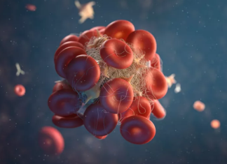 SIMPTOMI KRVNIH UGRUŠAKA U TIJELU: AKO TO PRIMIJETITE, ODMAH POTRAŽITE MEDICINSKU POMOĆ