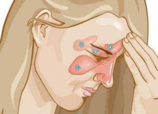 EVO KAKO DA OČISTITE SINUSE OD GNOJA I SLUZI: Za 10 dana ćete disati punim plućima!