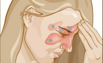 EVO KAKO DA OČISTITE SINUSE OD GNOJA I SLUZI: Za 10 dana ćete disati punim plućima!