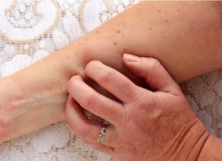 10 ZNAKOVA DA KARCINOM RASTE U VAŠEM TIJELU: Broj 3. svi zanemaruju, a to je znak za uzbunu!