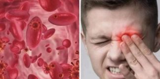 OVO SU SIMPTOMI NISKOG ŽELJEZA U KRVI: Tijelo vas upozorava JEDNIM SIMPTOMOM – ODMAH REAGUJTE