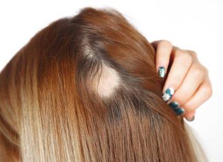 Ne možete spavati, nokti su vam krhki ili vam opada kosa: ovo vaše tijelo traži