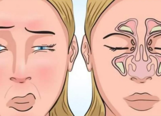 Glava boli na svaku promjenu vremena – OVO JE NAJMOĆNIJI LIJEK ZA SINUSE: Uradite ovo prije spavanja i SVE ĆE PROČISTITI