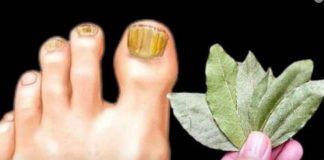 Ova domaća KUPKA trenutno ubija gljivice na noktima: Pomoći će čak i u najgorim slučajevima!