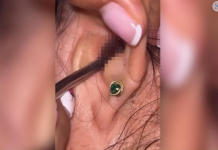 SVRBELO JE UVO, kada je otišla ljekaru Š0KIRALA SE: Kada su videli šta je unutra nisu mogli da veruju svojim očima! (FOTO)