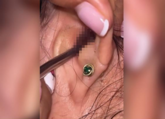 SVRBELO JE UVO, kada je otišla ljekaru Š0KIRALA SE: Kada su videli šta je unutra nisu mogli da veruju svojim očima! (FOTO)