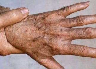 Najvažniji MINERAL Za TRAJNO UKLANJANJE STARAČKIH MRLJA!