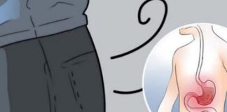 ZIJEVATE, IMATE GASOVE I NOGE SU VAM STALNO HLADNE? Evo koji zdravstveni problem imate!