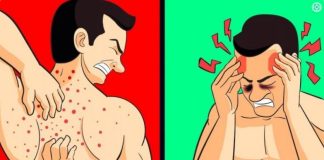 VAŠE TIJELO VAM ŠALJE UPOZORENJE: 12 znakova da jedete previše šećera SHVATITE OZBILJNO! Broj 5 nikako ne zanemarujte!