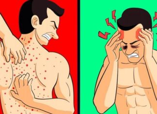 VAŠE TIJELO VAM ŠALJE UPOZORENJE: 12 znakova da jedete previše šećera SHVATITE OZBILJNO! Broj 5 nikako ne zanemarujte!