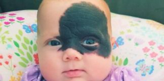 Nakon rođenja, otac od nje glavu okretao, a majka vrištala od šoka: Začudili su se da danas Natalija ovako izgleda