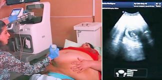 Trudna žena ima 226 kilograma i došla je na ultrazvuk, a onda je medicinska sestra podigla njen stomak i pogledala bolje… (VIDEO)