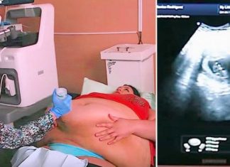 Trudna žena ima 226 kilograma i došla je na ultrazvuk, a onda je medicinska sestra podigla njen stomak i pogledala bolje… (VIDEO)