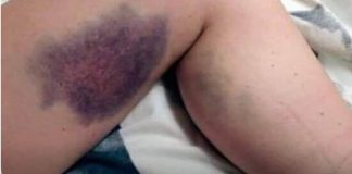 Vitamini koje je zabranjeno uzimati zajedno, ALI NIKO NE ZNA, MOGU BITI OPASNI