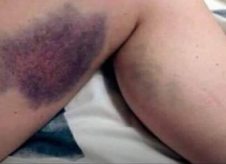 Vitamini koje je zabranjeno uzimati zajedno, ALI NIKO NE ZNA, MOGU BITI OPASNI