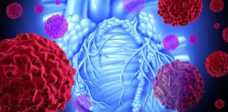 8 simptoma srčanog udara kod žena: Često se ignorišu, a posledice mogu biti fatalne