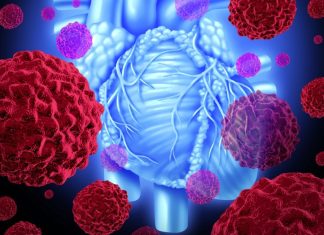 8 simptoma srčanog udara kod žena: Često se ignorišu, a posledice mogu biti fatalne