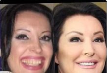 KAD SU SKUPILI PARE, URADILI SU ZUBE: POGLEDAJTE kako su izgledale domaće ličnosti PRIJE UMJETNIH ZUBA – CECA JE HIT (FOTO)