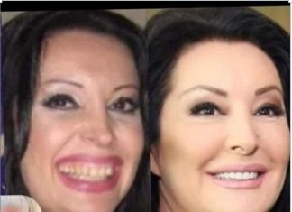 KAD SU SKUPILI PARE, URADILI SU ZUBE: POGLEDAJTE kako su izgledale domaće ličnosti PRIJE UMJETNIH ZUBA – CECA JE HIT (FOTO)