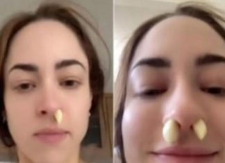 Da li je ovo stvarno upalilo? Katarina stavila beli luk u nozdrve i sačekala 10 minuta – šokirala se rezultatom!! Ovo morate probat…