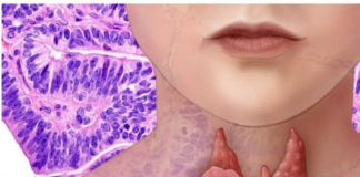 AKO IMATE PROBLEM SA ŠTITNOM ŽLIJEZDOM, OVE 2 NAMIRNICE IZBACITE: Štitna žlijezda ih nikako ne voli