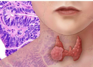 AKO IMATE PROBLEM SA ŠTITNOM ŽLIJEZDOM, OVE 2 NAMIRNICE IZBACITE: Štitna žlijezda ih nikako ne voli