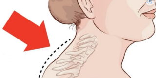 Kiropraktičar je pokazao 3 jednostavne vježbe koje će vam pomoći da uklonite “Grbu” u vratu: 0vo mi je najviše pomoglo! VIDEO