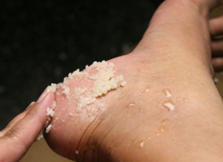 GENIJALAN RECEPT ZA GRUBE RUKE, ISPUCALE PETE, KURJE OČI I KRIVE NOKTE NA NOGAMA: Obavezno zapišite, nećete se pokajati