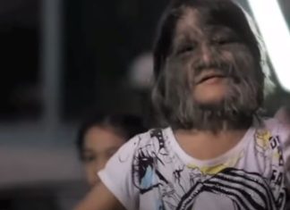 DEVOJKA SA LICEM MAJMUNA SE UDALA PA OBRIJALA LICE: Kada su je videli, ljudi se šokirali! Pogledajte kako SADA IZGLEDA