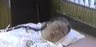 Sa 16 je obolela od gripa i pala u komu iz koje se nije budila 42 godine: Kad je otvorila oči, majka zanemela od prizora