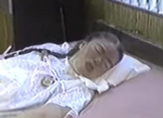 Sa 16 je obolela od gripa i pala u komu iz koje se nije budila 42 godine: Kad je otvorila oči, majka zanemela od prizora