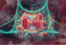 Sedam ranih simptoma raka grla koje ne smete ignorisati: Često se mešaju sa bezazlenim infekcijama