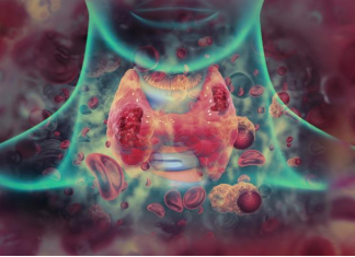 Sedam ranih simptoma raka grla koje ne smete ignorisati: Često se mešaju sa bezazlenim infekcijama