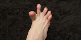 DA LI VAM SE GRČE PRSTI NA STOPALIMA ? Evo Na Šta Vas To Upozorava, Može Biti Znak Većih Problema