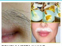 ZBOGOM DLAČICAMA: OVOM METODOM DLAČICE VIŠE NE RASTU