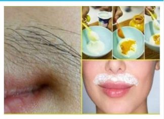 ZBOGOM DLAČICAMA: OVOM METODOM DLAČICE VIŠE NE RASTU