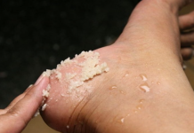 GENIJALAN RECEPT ZA GRUBE RUKE, ISPUCALE PETE, KURJE OČI I KRIVE NOKTE NA NOGAMA: Obavezno zapišite, nećete se pokajati