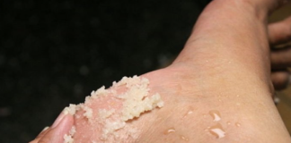 GENIJALAN RECEPT ZA GRUBE RUKE, ISPUCALE PETE, KURJE OČI I KRIVE NOKTE NA NOGAMA: Obavezno zapišite, nećete se pokajati