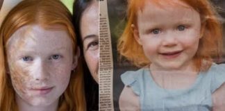 Imala je ožiljak preko celog lica i riđu kosu, nije ličila na roditelje, al je bila srećna i voljena: A onda je slika u novinama otkrila jezivu istinu o njoj