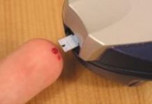 Najraniji znak da vam šećer razara organizam: Obratite pažnju na 1 opasan simptom