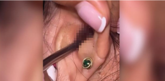 SVRBELO JE UVO DO BESVESTI, OTIŠLA U BOLNICU, A TAMO ŠOK: Kada su videli šta je unutra nisu mogli da veruju svojim očima! (FOTO)