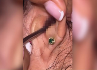 SVRBELO JE UVO DO BESVESTI, OTIŠLA U BOLNICU, A TAMO ŠOK: Kada su videli šta je unutra nisu mogli da veruju svojim očima! (FOTO)