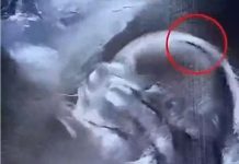 „Beba rođena s gustom kosom oduševila bolnicu – i celu zajednicu“