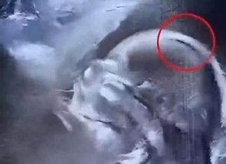 „Beba rođena s gustom kosom oduševila bolnicu – i celu zajednicu“