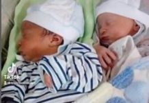 RODILA BLIZANCE, PA ZANEMELA OD ŠOKA: Lekari trčali da ih vide, otac mislio da je greška, sad imaju 5 godina i ČUDNI SU