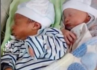 RODILA BLIZANCE, PA ZANEMELA OD ŠOKA: Lekari trčali da ih vide, otac mislio da je greška, sad imaju 5 godina i ČUDNI SU