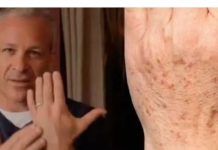 Sok od luka + jabukovo sirće: Samo pomiješajte i riješite se staračkih pjega narukama, licu i dekolteu jednom za svagda!