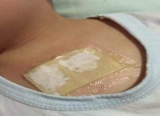 Ovaj kućni lijek rastvara sluz u plućima i oslobađa kašlja. Preko noći uklanja i najteži kašalj, te čisti pluća od nakupljene sluzi!